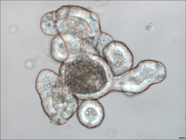 Bright field image of a mouse intestinal organoid.