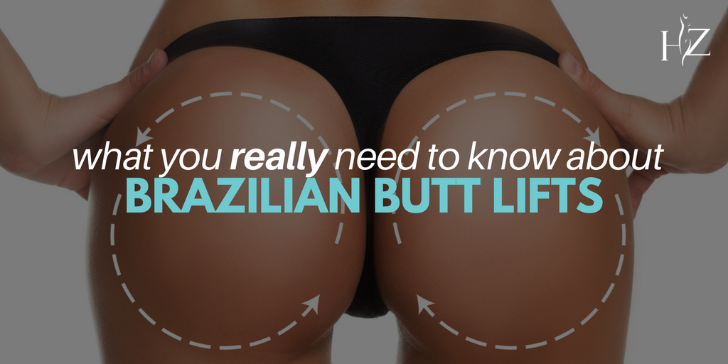 Brazilian Butt Lift: Everything you need to know about this procedure