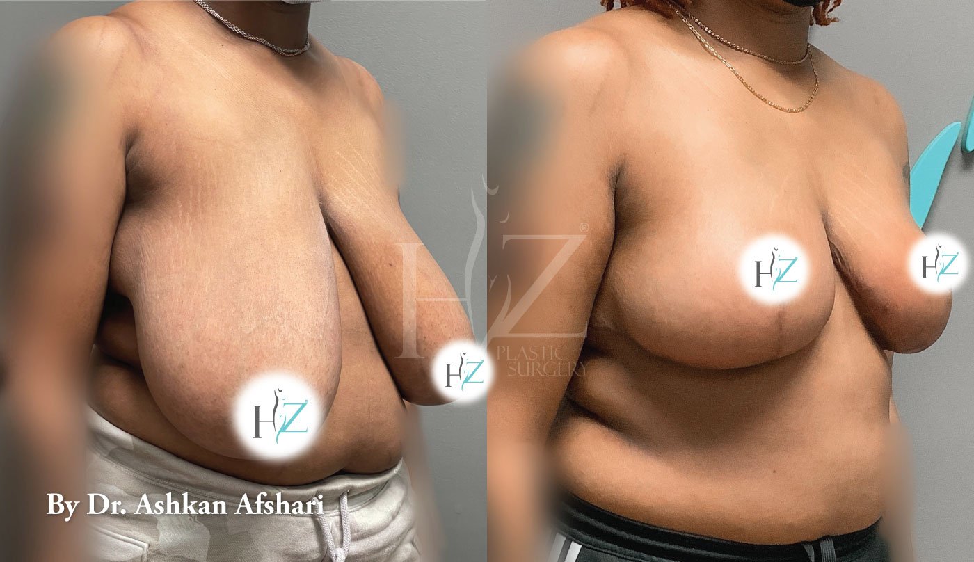 hz plastic surgery, best plastic surgeon near me, plastic surgery orlando, plastic surgeon orlando