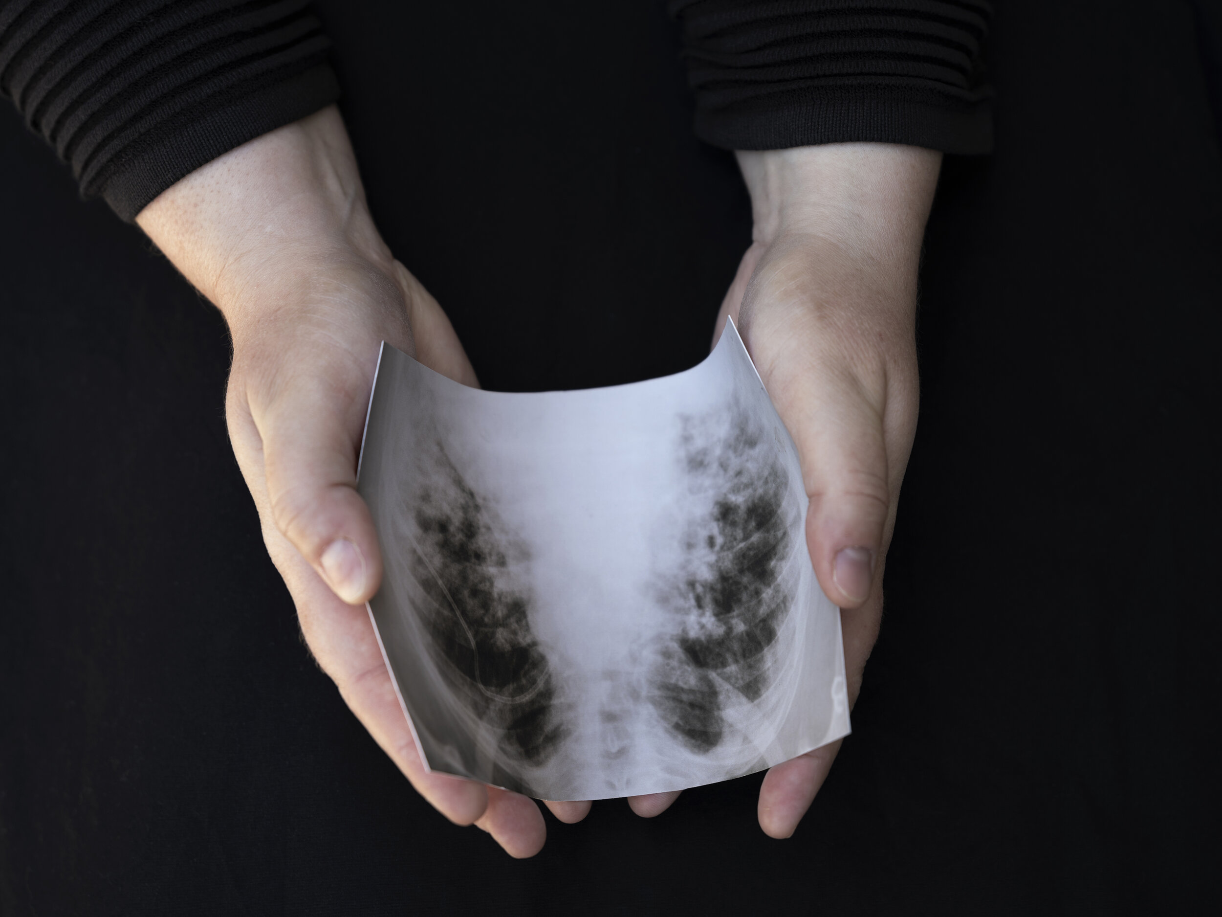 Of capacity and breath