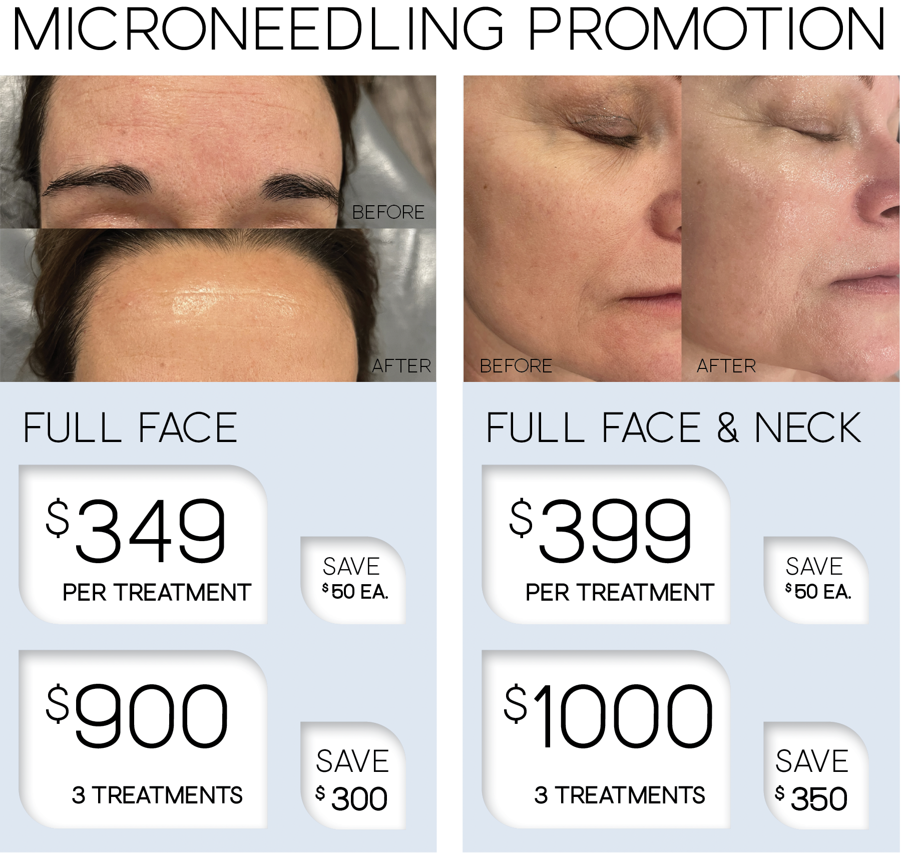Microneedling promo