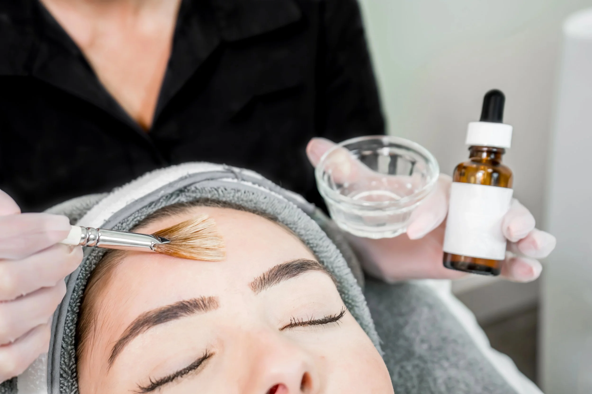 Vita Bright Peel