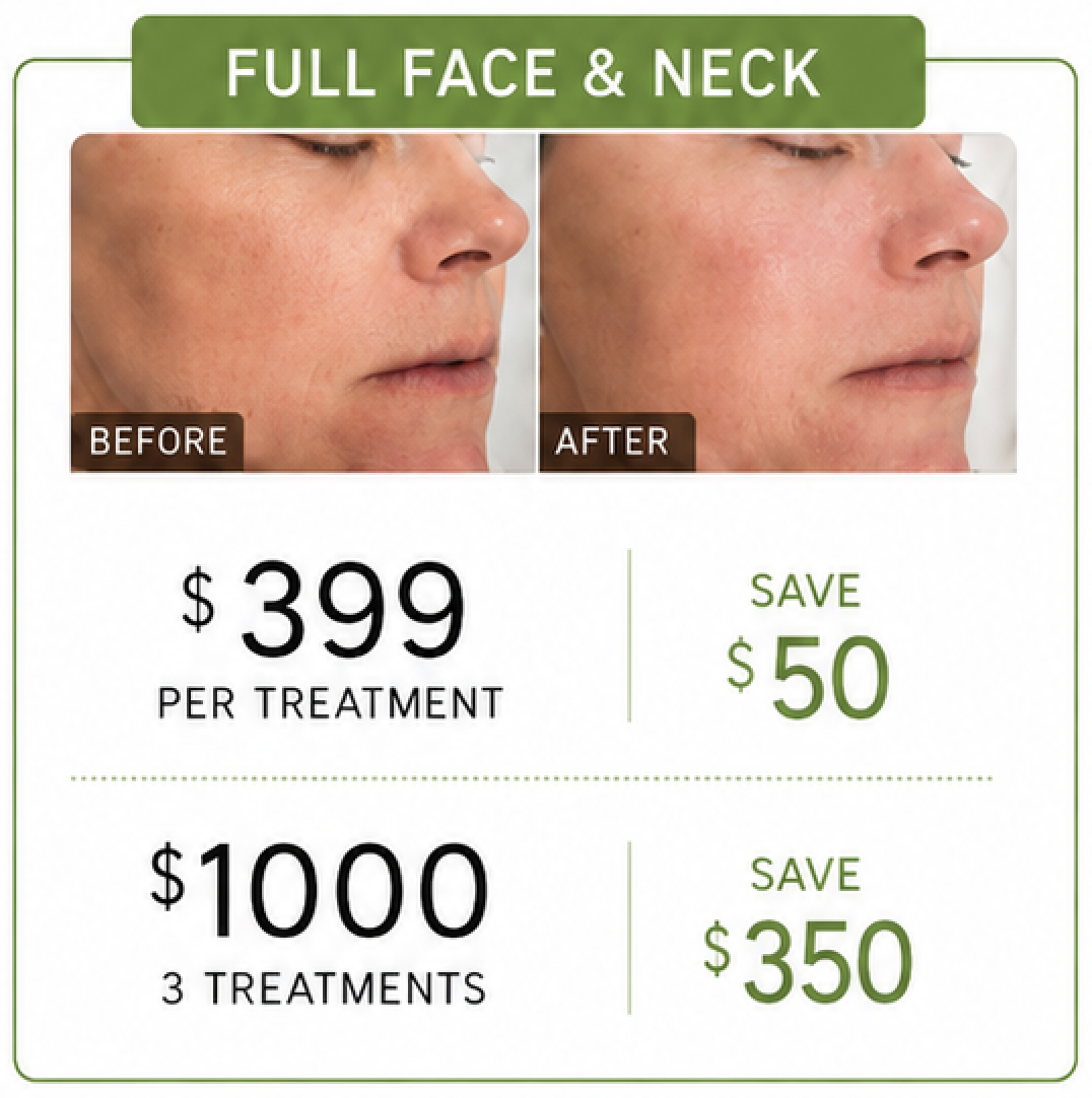 Full Face & neck
