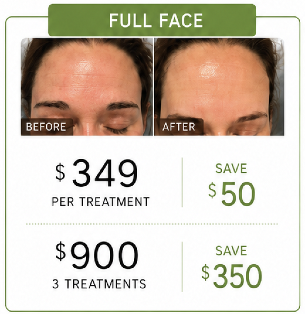 microneedling face promo