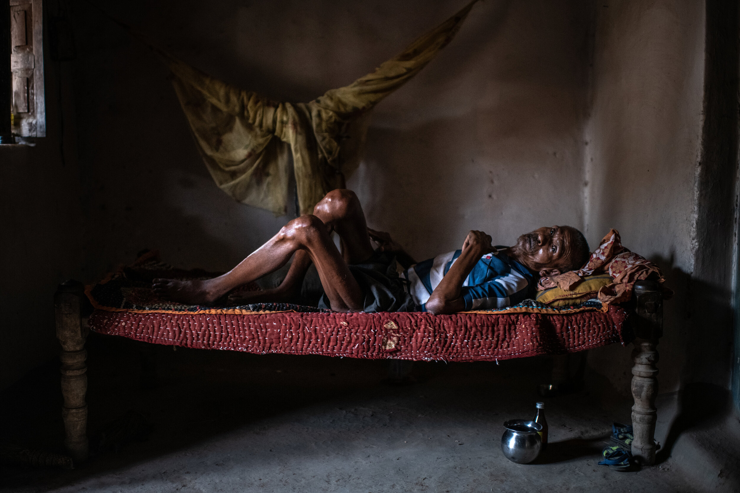  6/16/2019 Raspahari, Uttar Pradesh, India.   Mishri Lal, 58, lay bedridden in his home in Raspahari. A carpenter by trade, Mr. Lal began to suffer stiffness in his legs 8-10 years ago but in the last five months has become unable to walk. Mr. Lal su