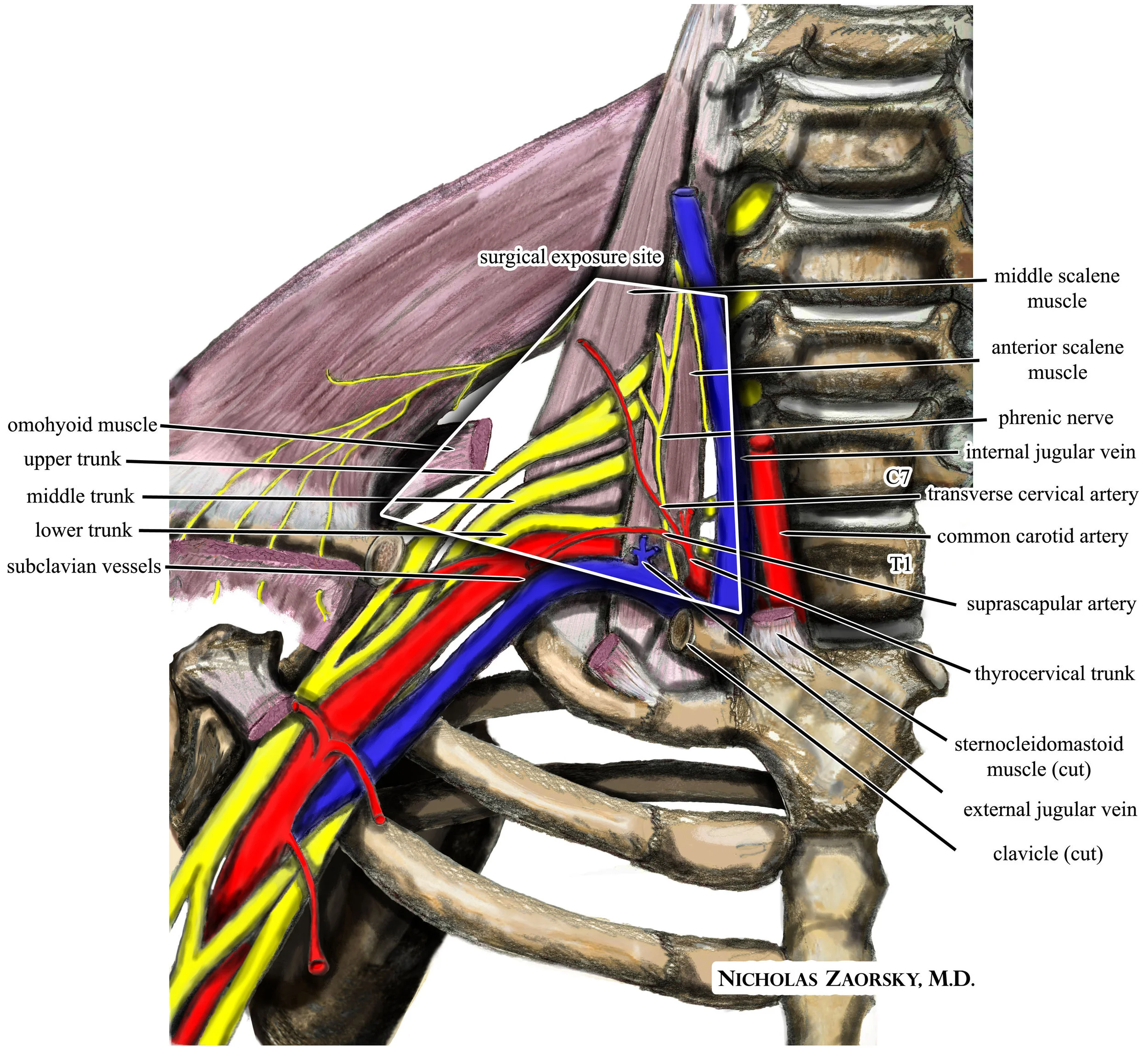 Wikipedia_medical_illustration_thoracic_outlet_syndrome_brachial_plexus_anatomy_with_labels.jpg