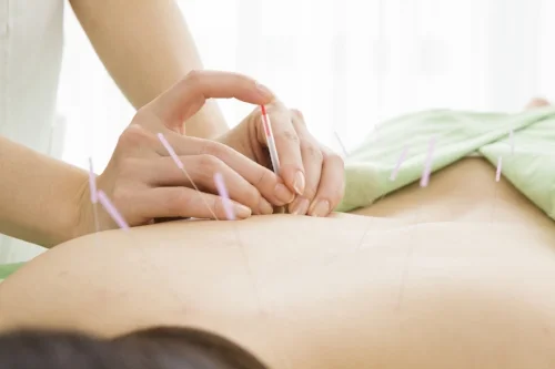 FAQ - Does my insurance cover acupuncture?