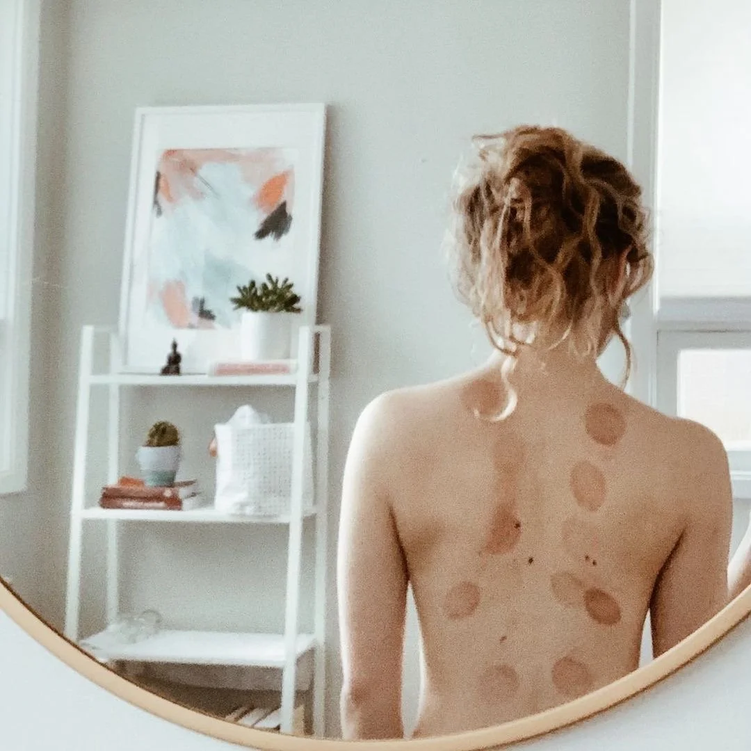 Now offering standalone Cupping Treatments!
