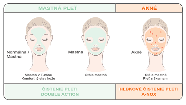 a-nox-vs-double-action_1.gif