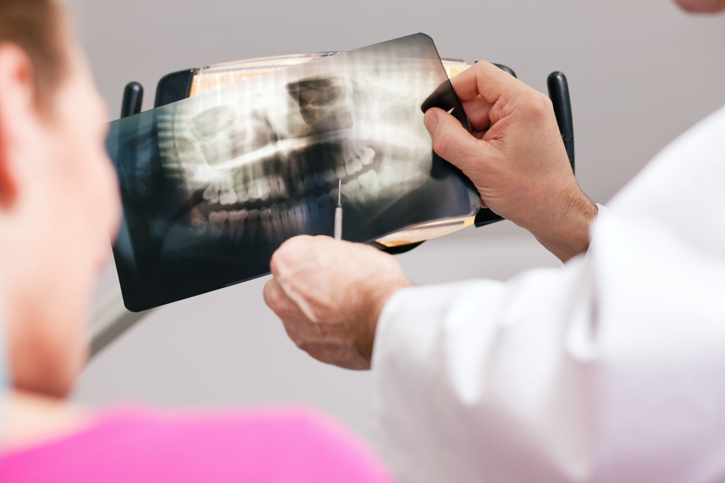 xray.jpg