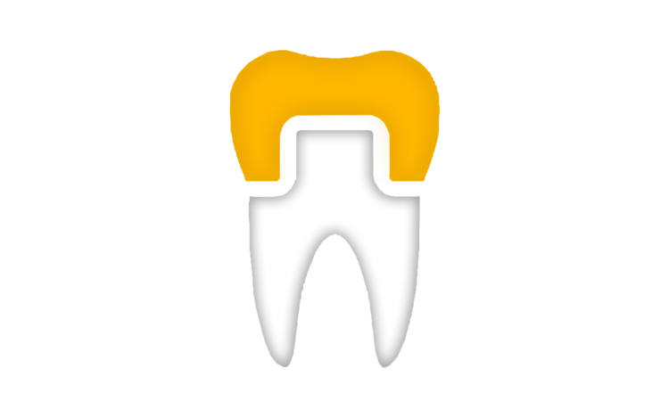 Coronas Dentales