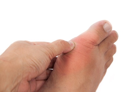 5 Signs of Toenail Problems and What They Mean
