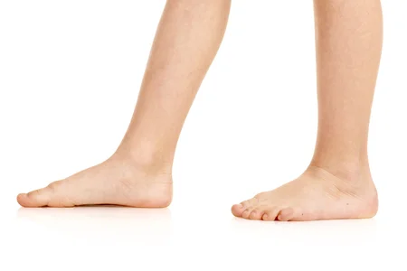 100535156_S_child_flat_feet_stand_toes.jpg