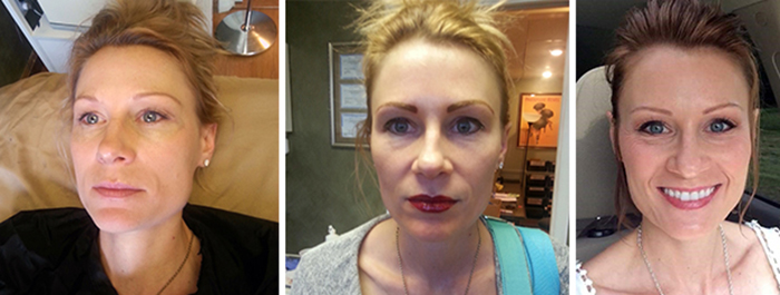 Permanent Makeup Cosmetics - Permanent Makeup Springfield Mo Permanent Makeup Cosmetics - Permanent Makeup Springfield Mo