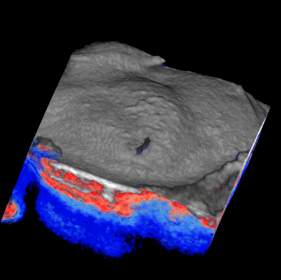OCT image of a live mouse cochlea. The otic capsule (bone) has been segmented and slowly recedes to reveal the underlying soft tissues of the cochlea in this volume rendering.