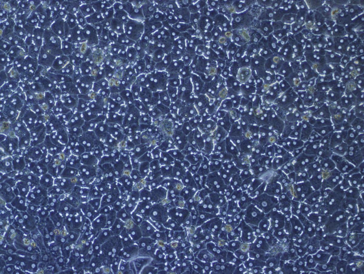 LiverCellLab-HF140%20overlay7.jpg
