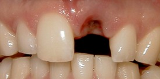 Before
