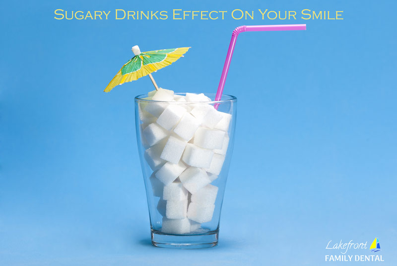 sugary-drinks-effect-on-smile.jpg
