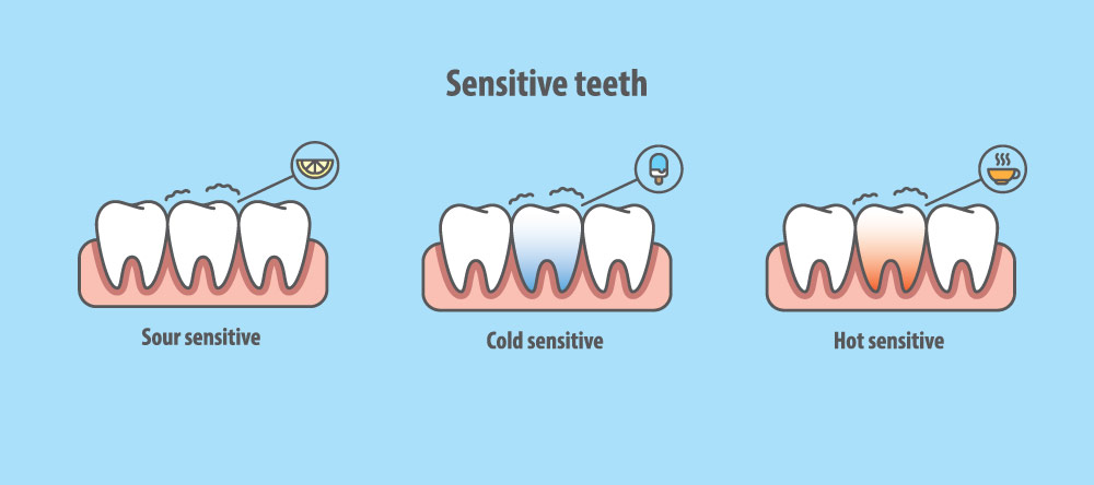 types-of-sensitivity.jpg