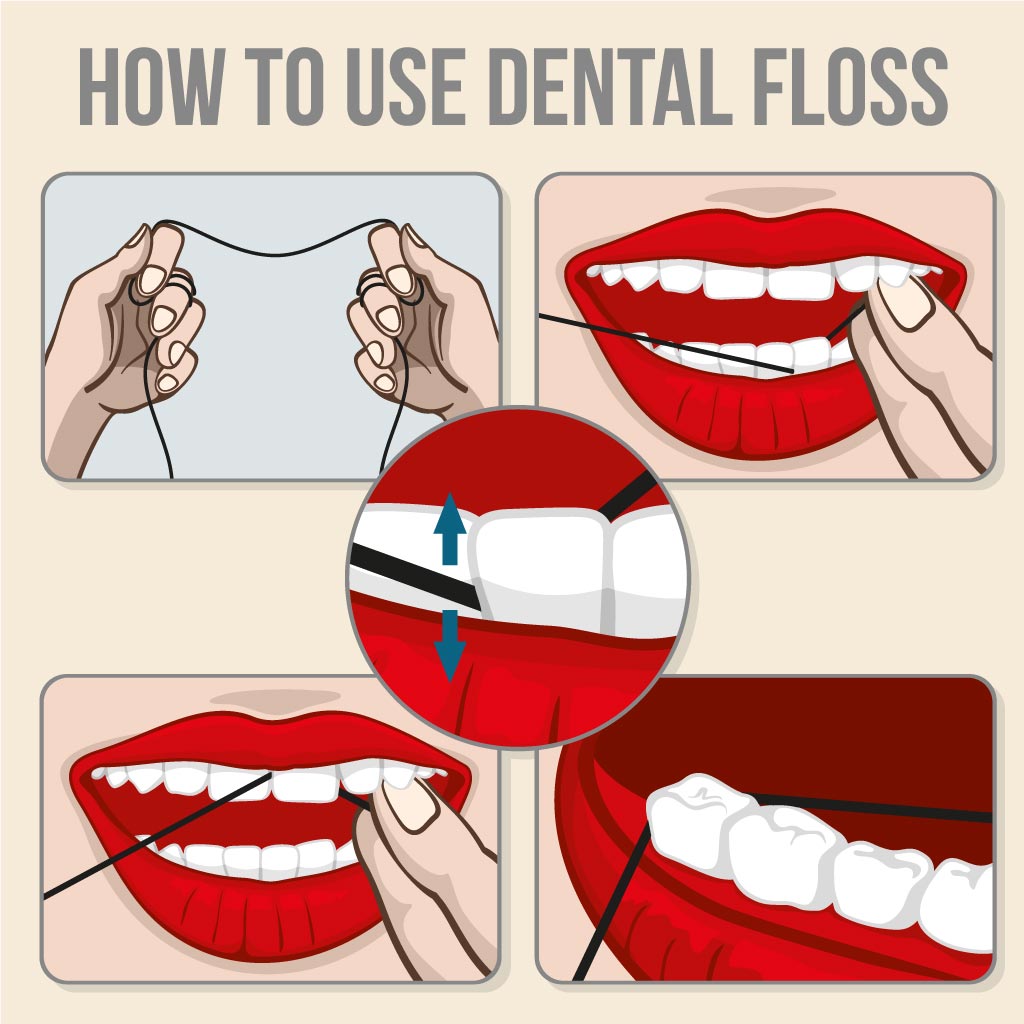 flossing-teeth.jpg