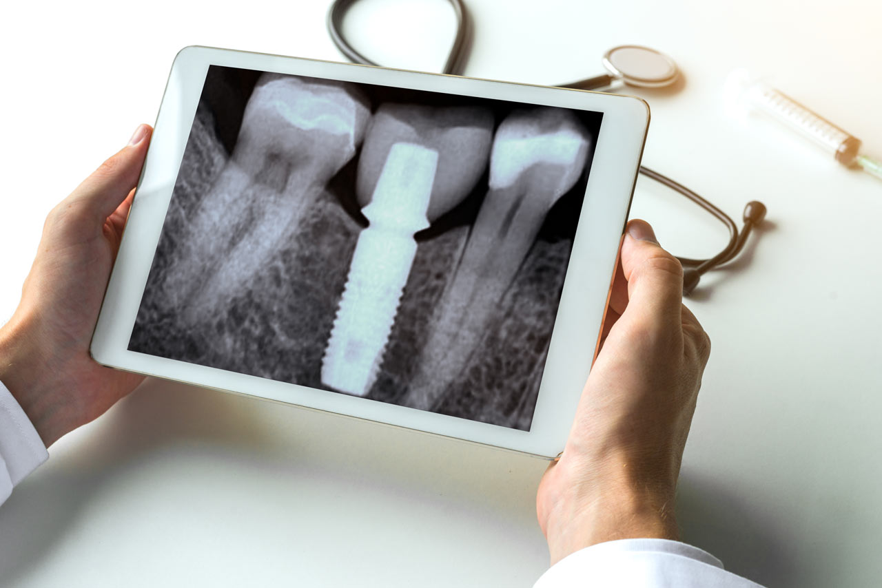 digital-dental-x-rays.jpg