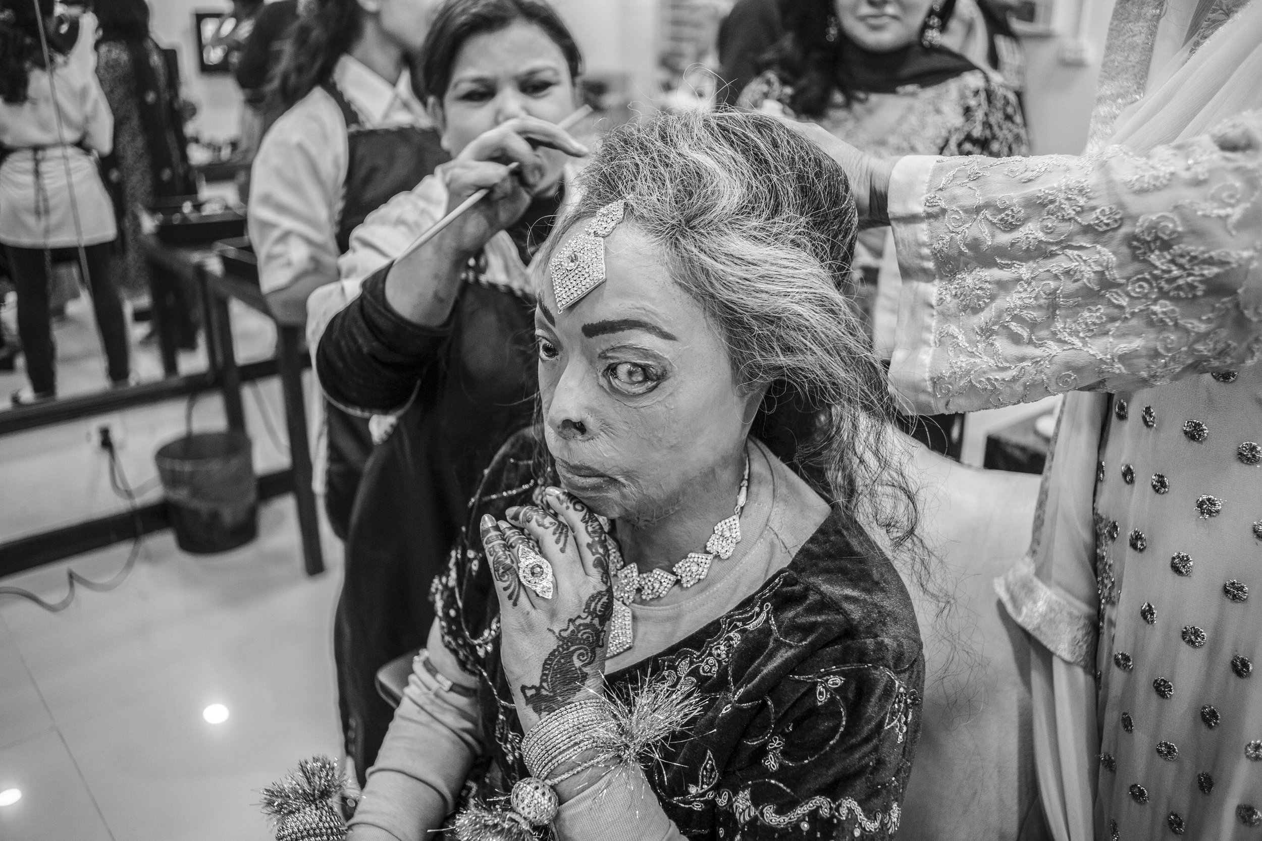  Sarwari Bibi, an acid attack survivor, gets dressed for her wedding ceremony at Depilex Salon, on Jan. 7, 2016 in Lahore, Pakistan. 