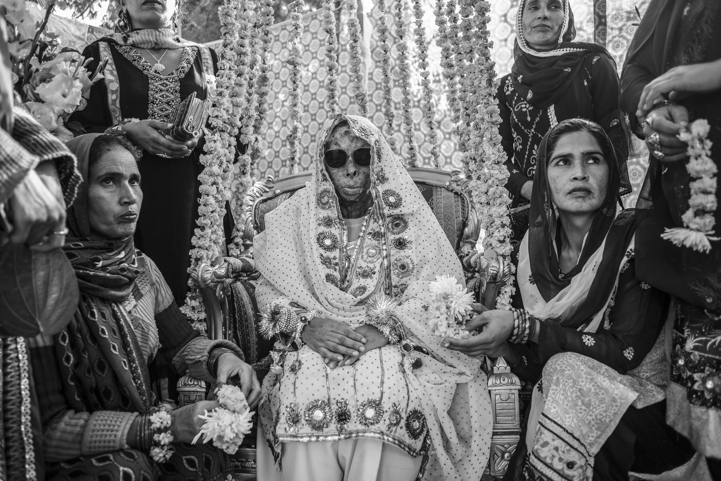  Sarwari Bibi, an acid attack survivor, sits with her sisters at her pre-wedding ceremony on Jan. 7, 2016 in Lahore, Pakistan. 