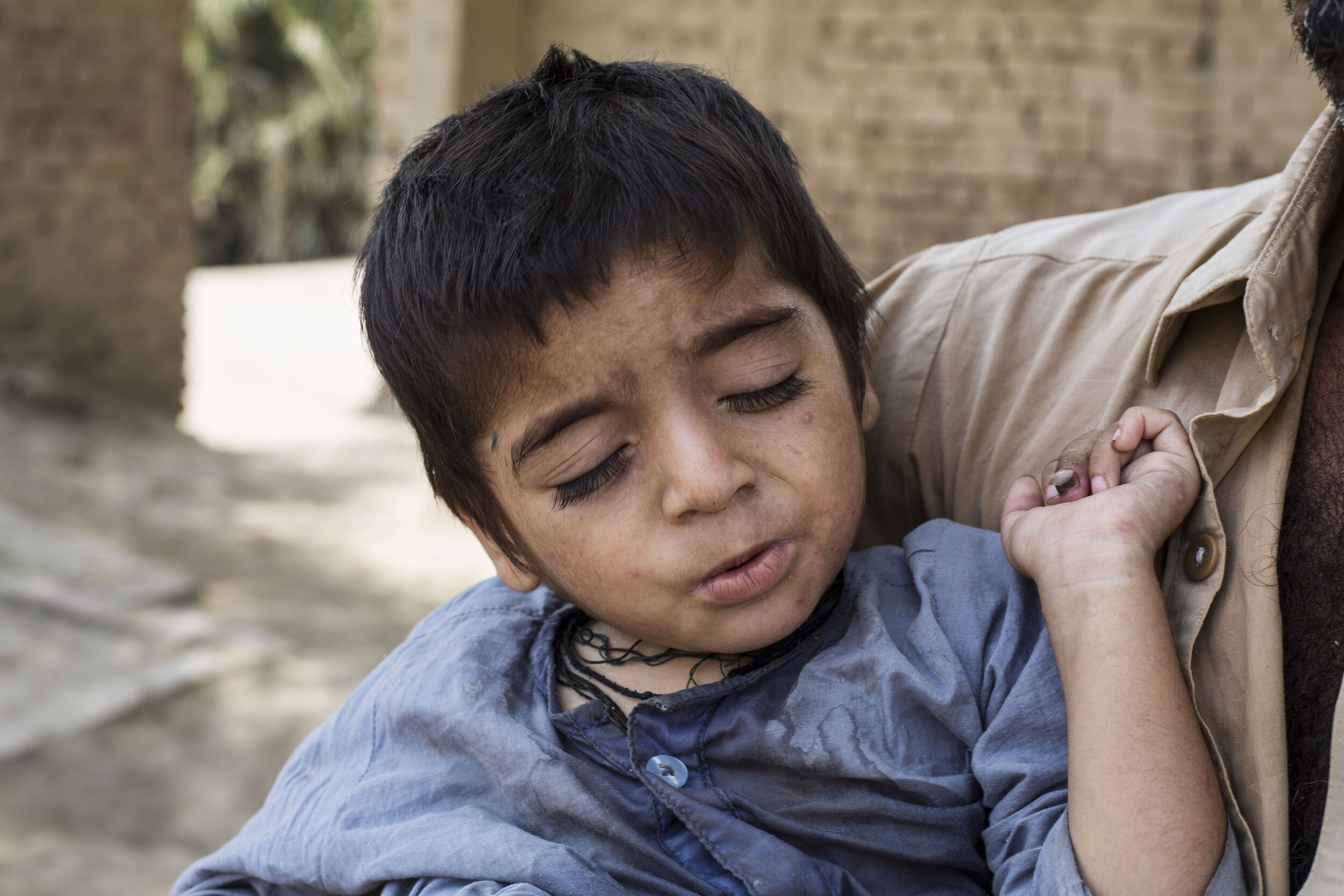 3-year-old Muhammad Ilyas has been diagnosed with HIV  on July 24, 2019 in village Thango Bozdar, Sind, Pakistan. 