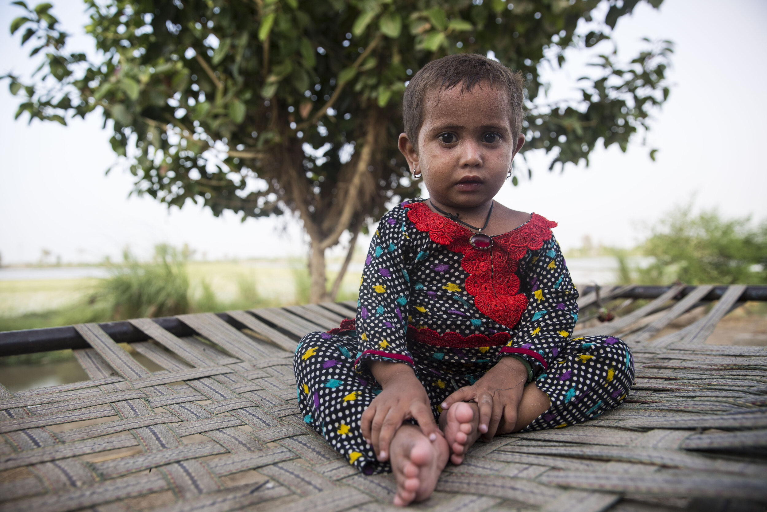  3-year-old Jeehjan who has been diagnosed with HIV in Subhani Shar village, around 8 km from Ratodero on July 25, 2019 in Sind, Pakistan.  