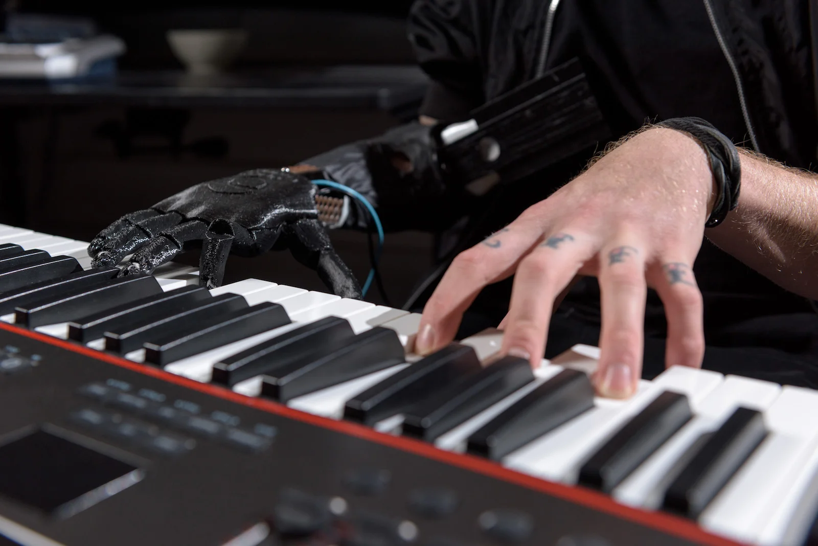 Playing Music with a Bionic Hand
