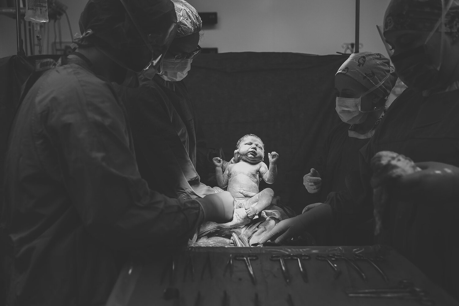 Calgary-Birth-Photographer-C-Section4.jpg