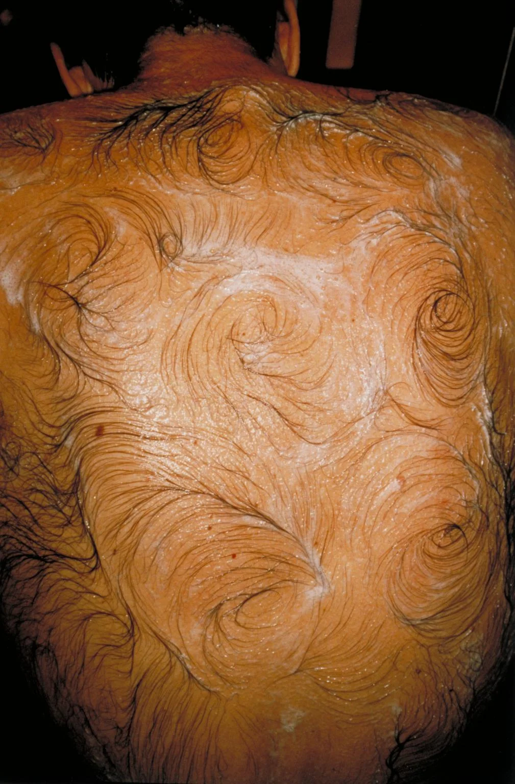 1995, Mona Hatoum, Van Gogh's Back.JPG