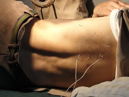 acupuncture-3275458__340.jpg