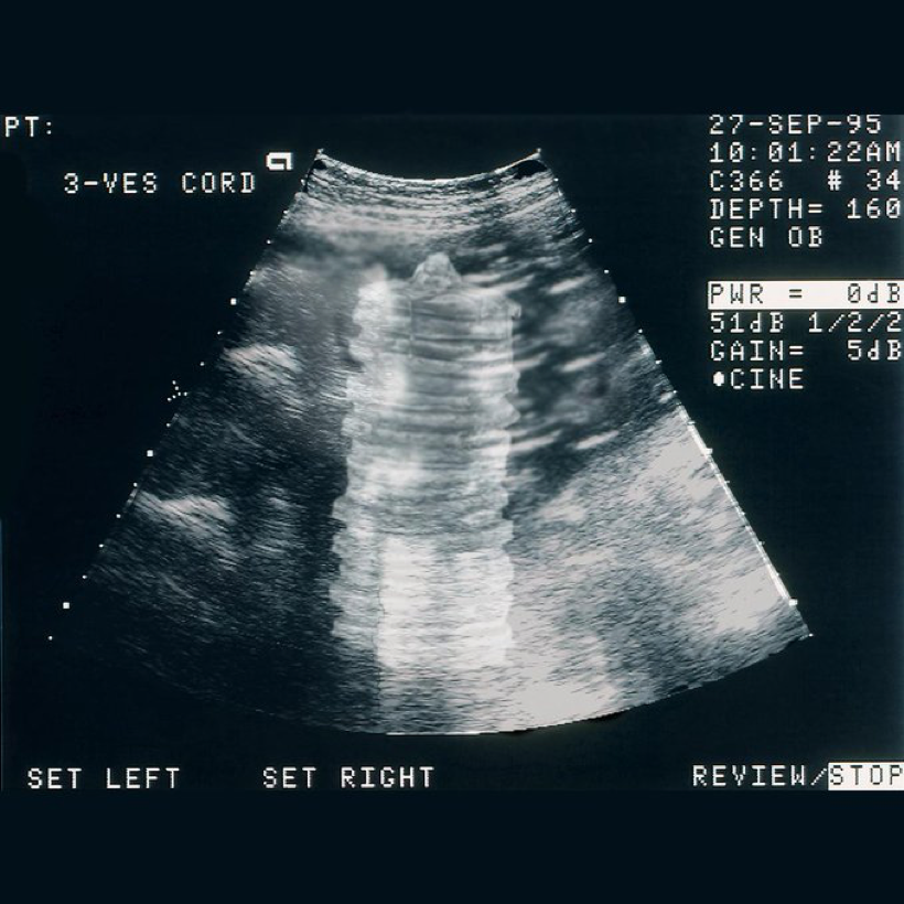 The Best Marketing Campaigns From the Food & Beverage Sector — Moondust