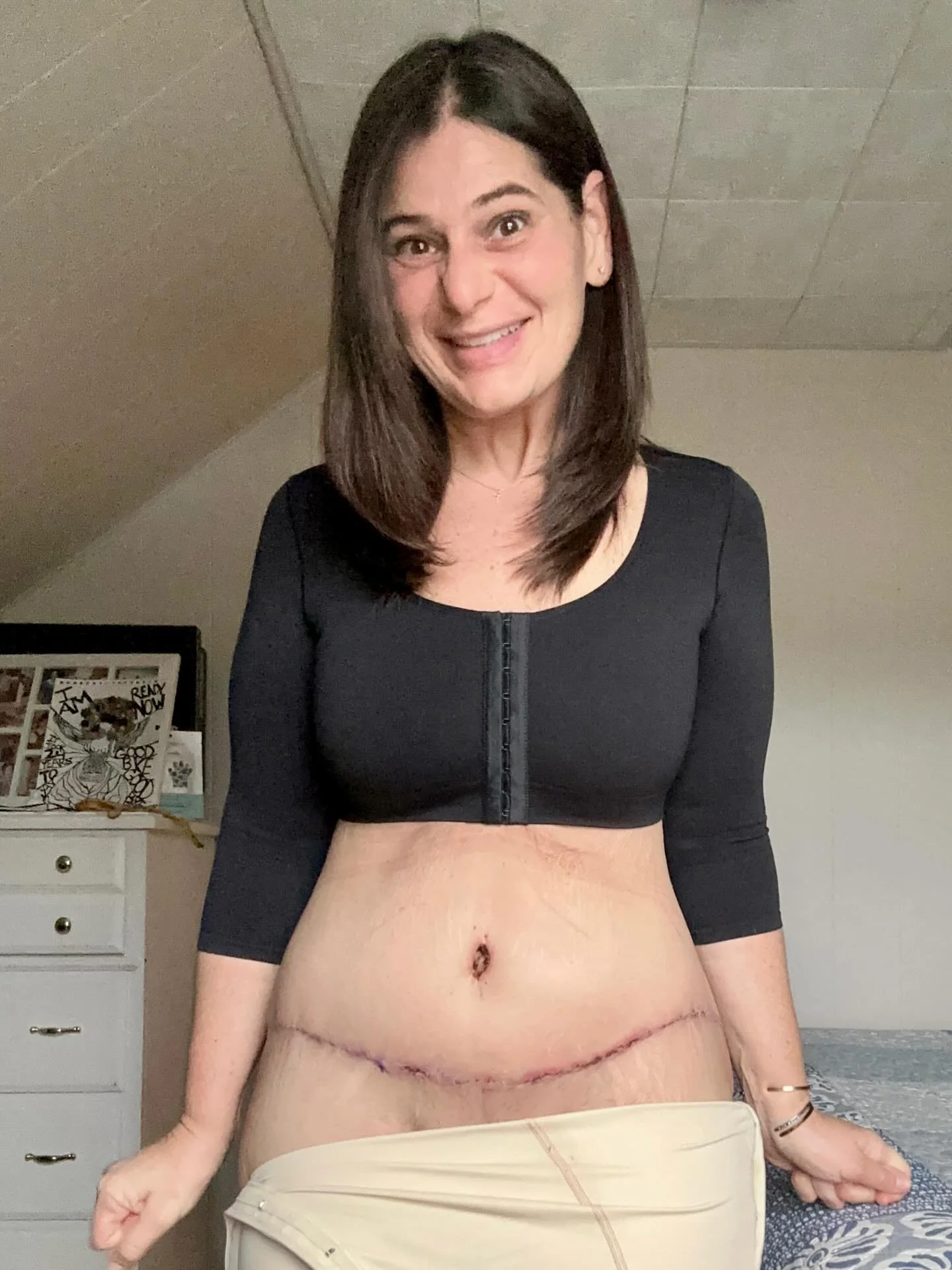 It&rsquo;s been 15 days since surgery and I&rsquo;ve finally taken a good look at myself. Seeing my body, not as an obese woman or with loose skin, has been emotional, mind bending and hard to describe. To see the physical manifestation of what I&rsq