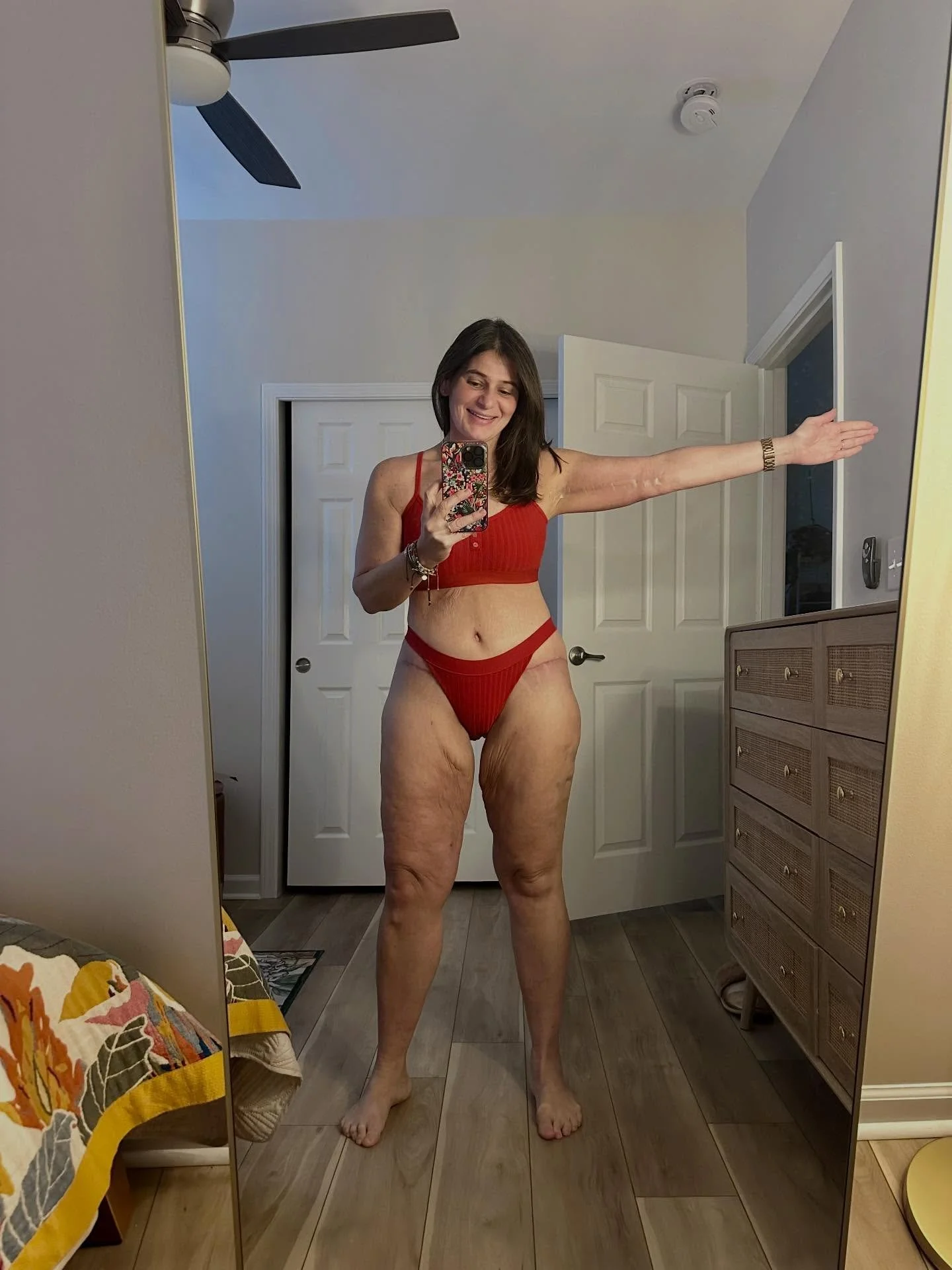 6 weeks post op. Throughout my whole entire life stretch pants (I&rsquo;m really dating myself here) and underwear rolled down and were uncomfortable. I have spent numerous hours hiking up underwear and or leggings &mdash; at work, when I stood up, d