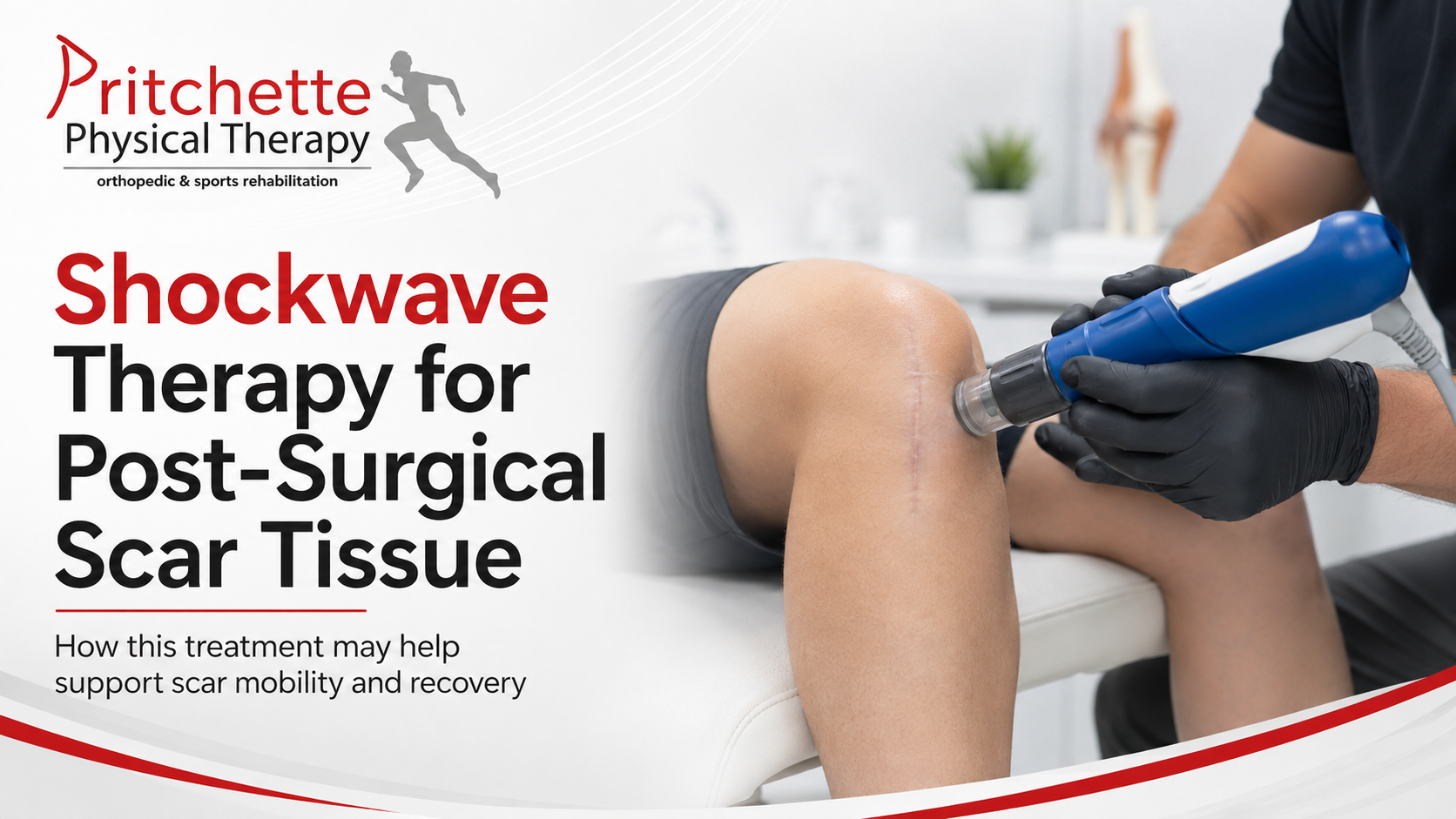 Can Shockwave Therapy Help with Post-Surgical Scar Tissue?