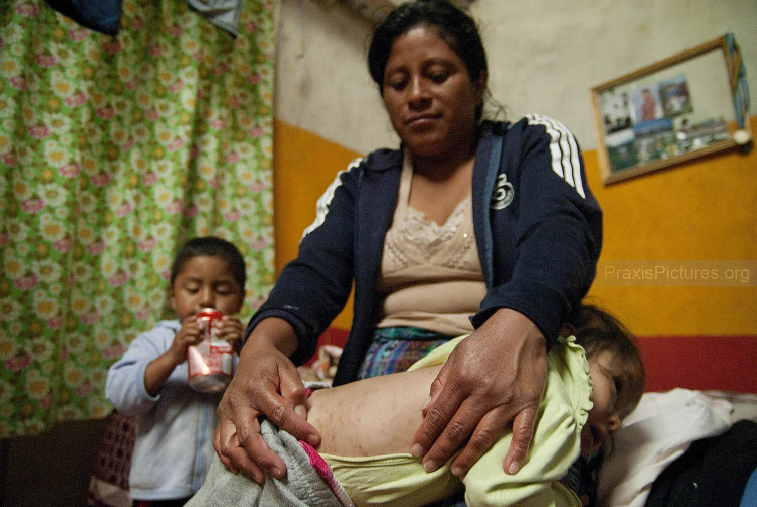 YAHIRA - “Since the company came we have diseases, before we didn’t have anything like this,” says Irma, whose daughter Yahira has similar itchy rashes all over her body. “Before the children were all healthy. Not any more! It is the mine’s fau…