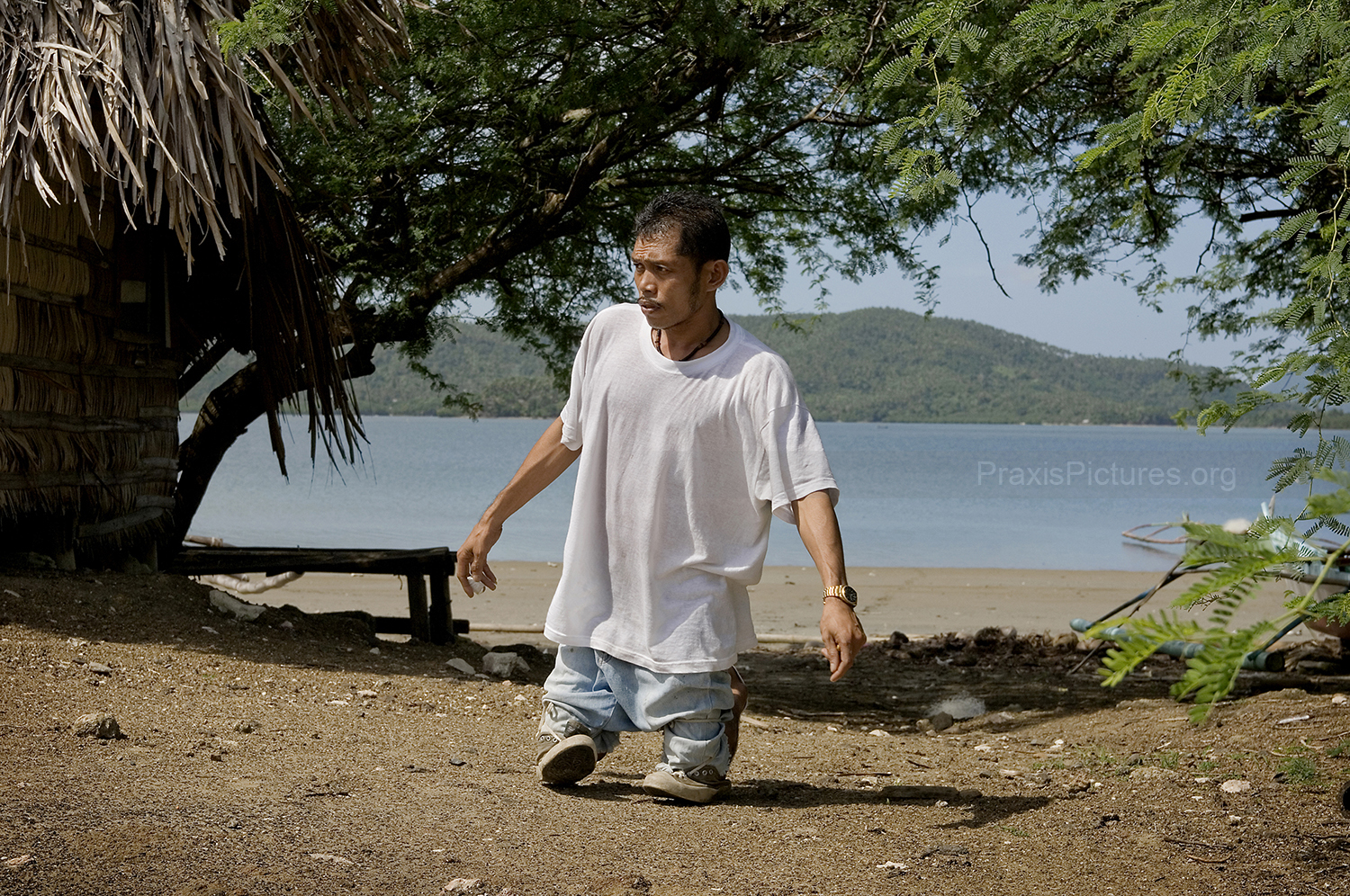 Wilson was a fisherman living in Calancan Bay in Marinduque where Placer Dome used to dump its mine waste. Over a period of sixteen years, Placer Dome dumped 200million tons of mine waste into the shallow coral-rich bay despite vocal opposition from the community. Many years ago Wilson went out into the bay with a small cut in his leg. As a result, Wilson suffered from mercury poisoning rendering his legs useless. One leg has been amputated, the other one will have to come off as well. The president of the company, John Dodge, continues to maintain that “the fishermen of Calancan Bay “ have not suffered in any way because of the tailings disposal .” Before, most of the 15,000 villagers in the area made a living from fishing in the bay for a few hours every other day. Now, there are more fishermen than fish, and the men have to go far out to sea everyday.