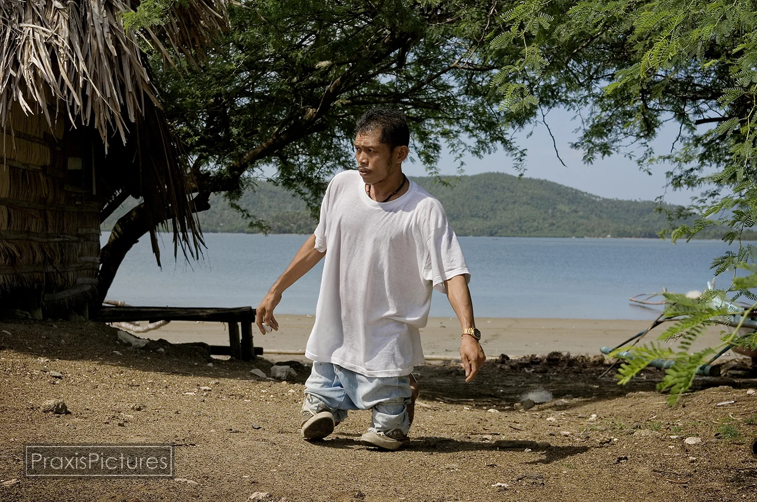 Over a period of sixteen years, Placer Dome dumped 200million tons of mine waste into the shallow coral-rich bay despite vocal opposition from the community. One day, when he was out fishing years ago, Wilson went out into the water with a small cut in his leg. As a result, Wilson suffered from mercury poisoning rendering his legs useless. One leg has been amputated, the other one will have to come off as well.