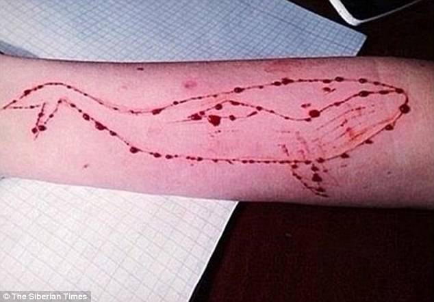 A posthumous photo of a teen tasked with carving a blue whale into her arm