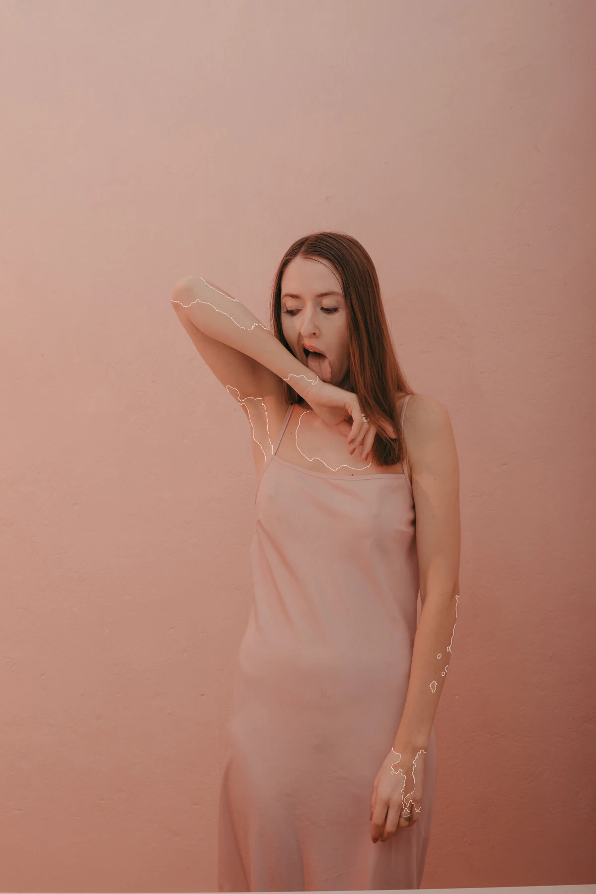 cheriebirkner-selfportrait-23-vitiligo.jpg
