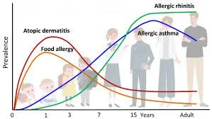 Allergic March Atopic March — London Allergy Consultants