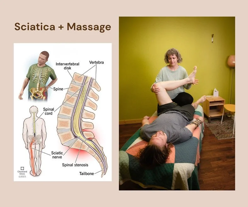 Rest and apply ice when you’re experiencing a sciatica flare up! And then come see us for a massage :)
