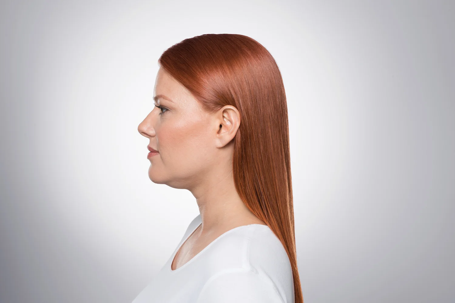 Pre-Kybella Treatments