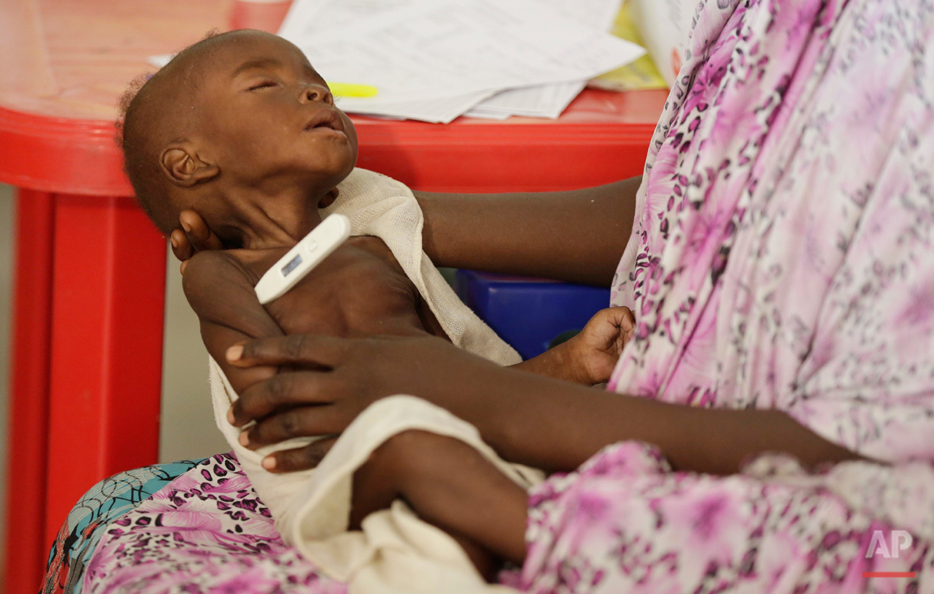 Nigeria's Starving Children
