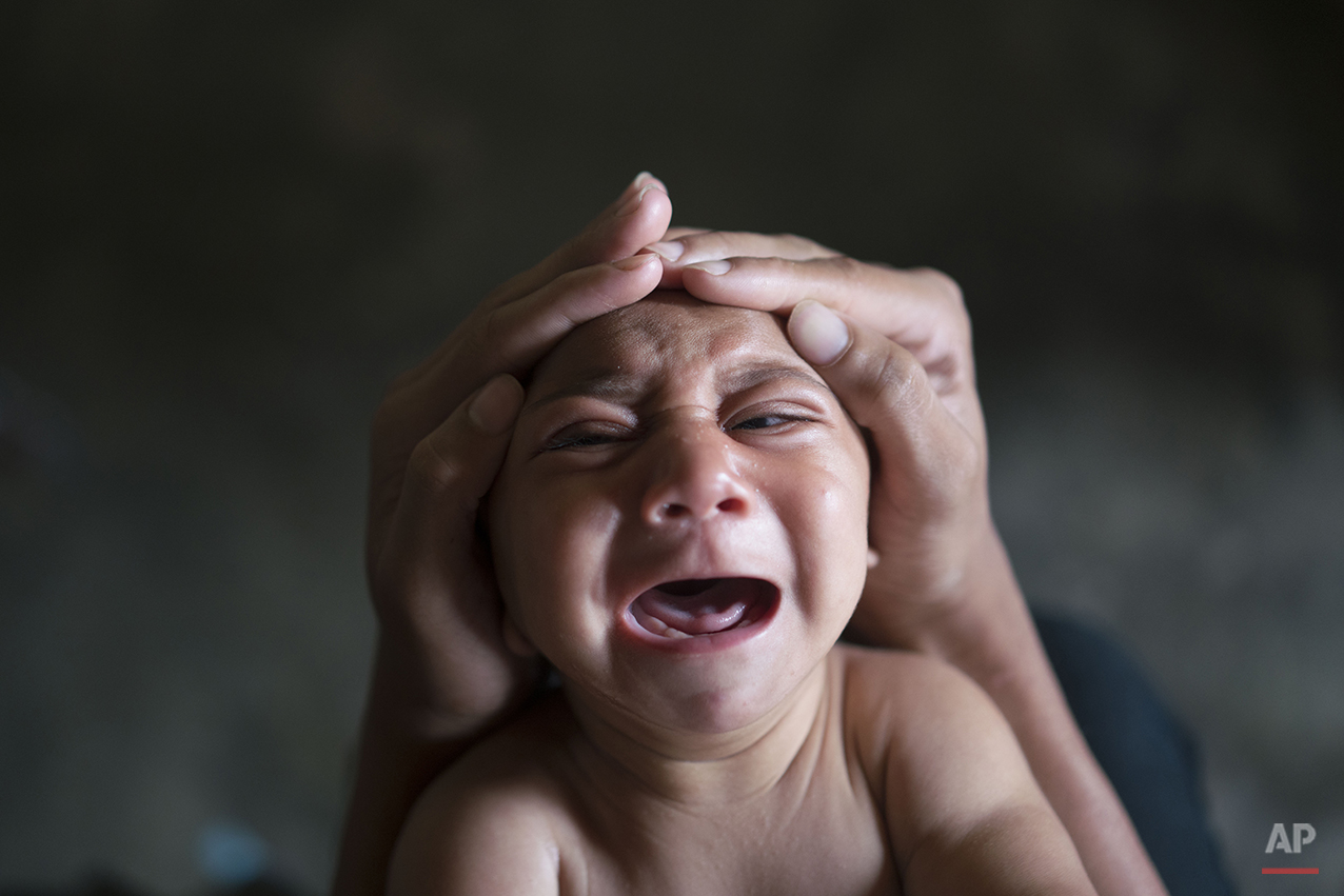  In this Jan. 30, 2016 photo, Elielson tries to calm down his baby brother Jose Wesley, in Bonito, Pernambuco state, Brazil. Jose Wesley was born with microcephaly and he screams uncontrollably for long stretches, getting red in the face and tighteni