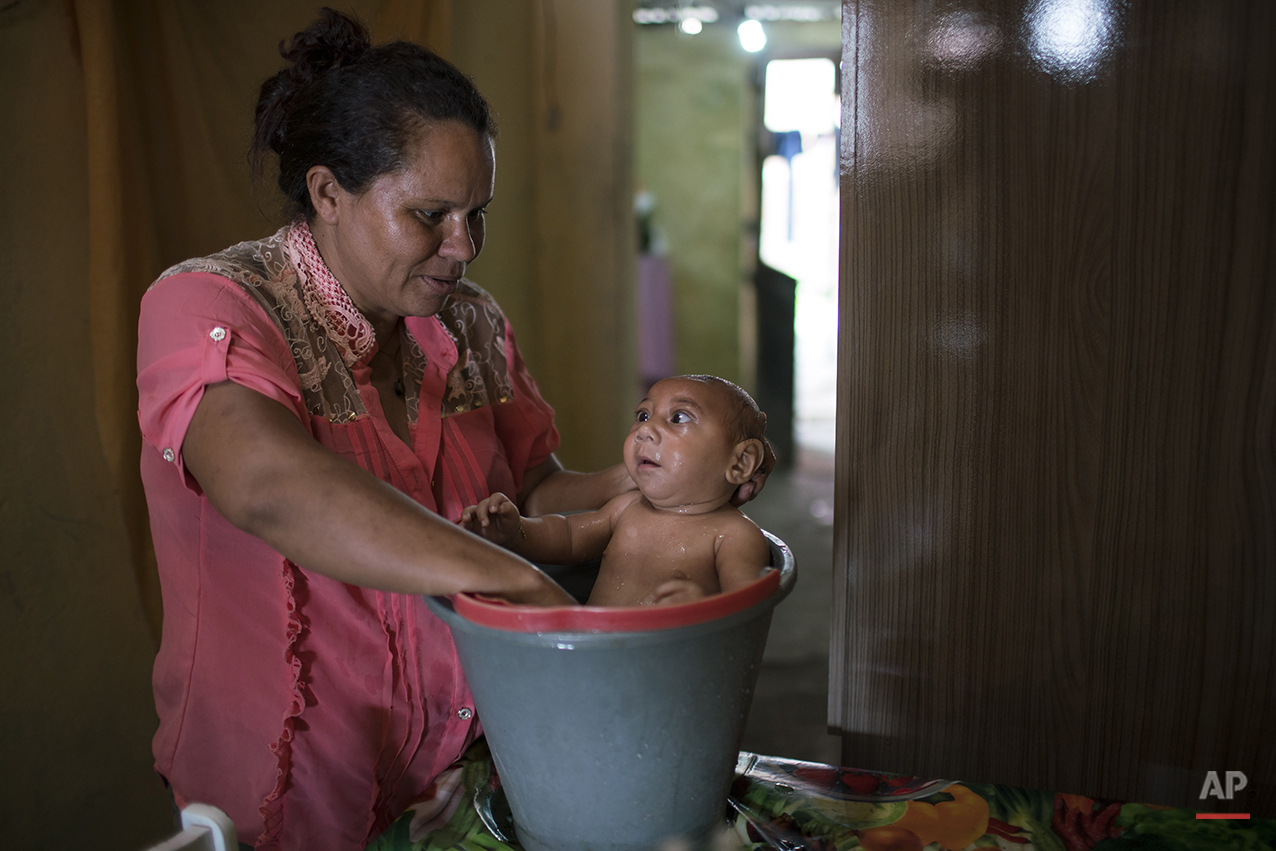  In the Jan. 30, 2016 photo, Solange Ferreira bathes her son Jose Wesley in a bucket at their house in Bonito, Pernambuco state, Brazil, Saturday. Jose Wesley who cries incessantly only calms down when he is placed in the bucket of water. A trick his