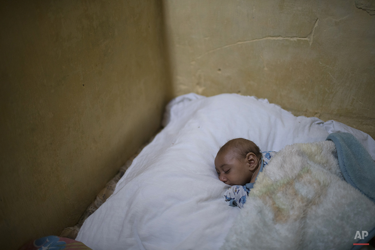  In this Jan. 30, 2016 photo, Jose Wesley sleeps over a large pillow on his mother's bead in Bonito, Pernambuco state, Brazil. Jose Wesley has lost weight, from 7 to 5 kilograms (15 to 11 pounds), a huge drop for a baby who should be growing. (AP Pho