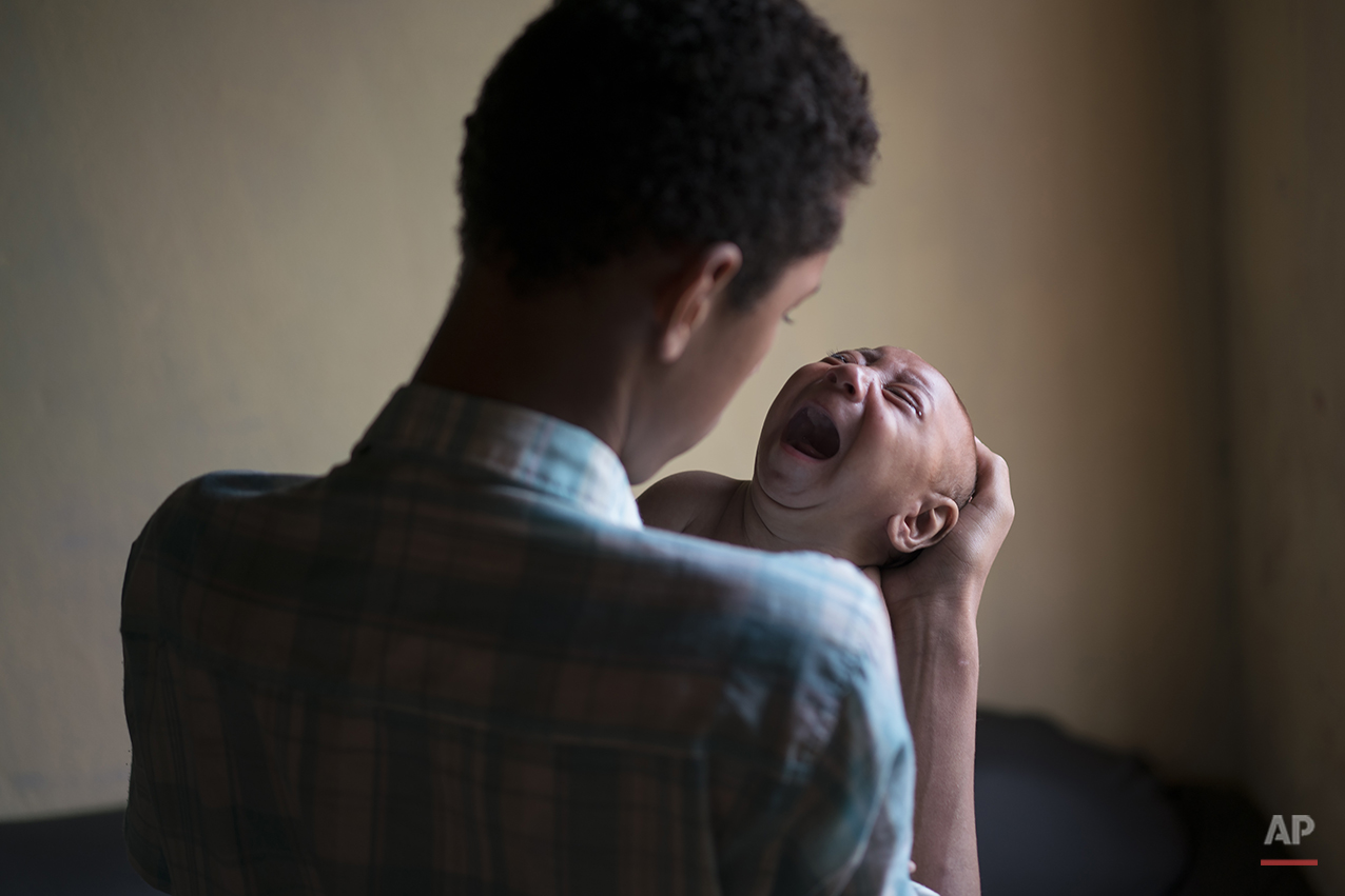  In this Jan. 30, 2016 photo, Elielson tries to calm down his baby brother Jose Wesley, in Bonito, Pernambuco state, Brazil. Jose Wesley struggles to feed, something common in children with neurological disorders like microcephaly. (AP Photo/Felipe D